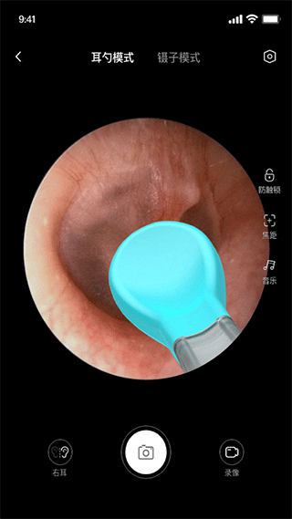 bebird智能可視采耳（3）